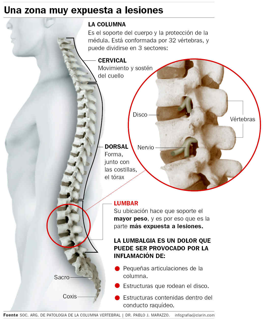 Rutina de ejercicios para dolor de espalda